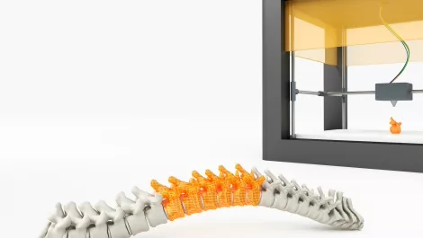 3D printing mainstream by 2018, medical sector leading charge